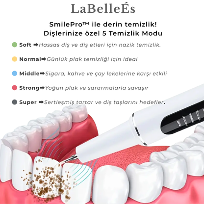 LaBelleÉs SmilePro™ Ultrasonik Diş Taşı Temizleyici – 5 Modlu LED’li Profesyonel Bakım Cihazı